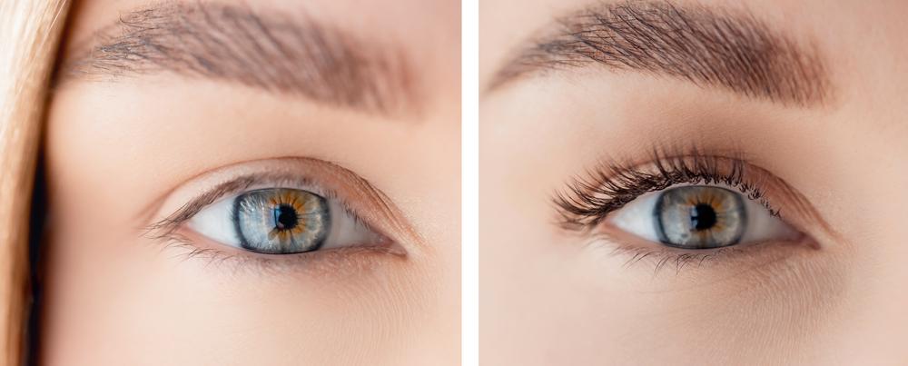 picture of woman before and after eyelash growth treatment