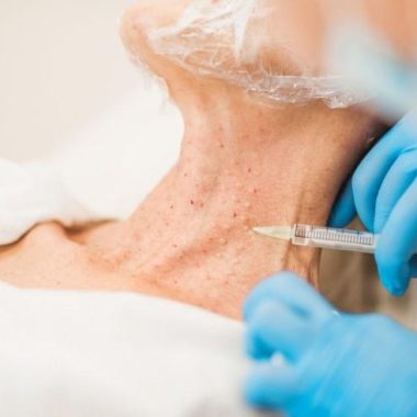 picture of a womans neck getting mesotherapy skin boosters treatment